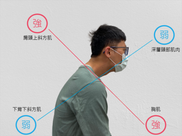 長時間低頭滑手機、看書、3C產品 姿勢不良成了「烏龜頸」  用這方式有機會矯正回來