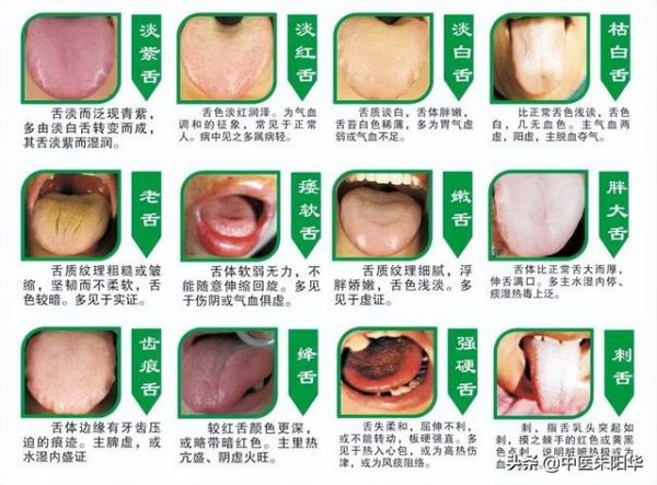 看中醫醫生為什麼要看舌頭？舌頭怎麼看身體狀況？一張圖讓你了解！