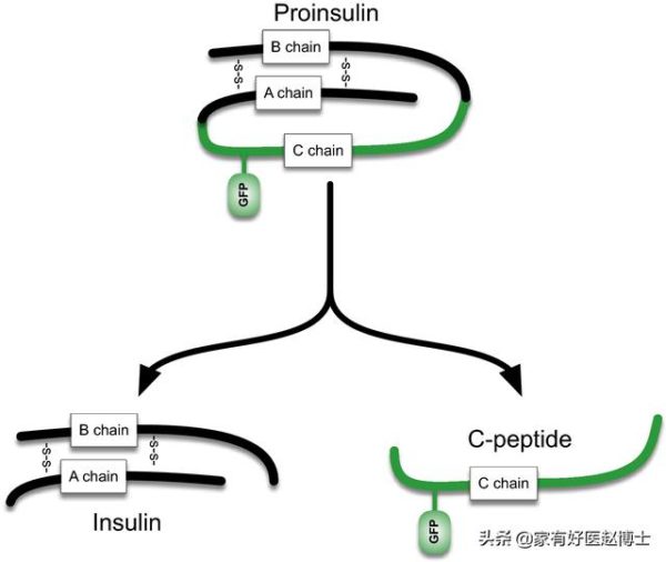 糖尿病患者的胰島功能怎麼查？胰島素/C肽釋放 怎麼看？