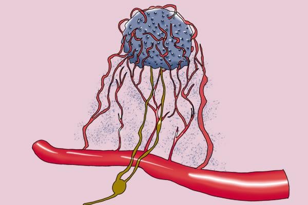 研究證實「運動真的能抗癌！」什麼運動效果最好呢？運動還有什麼好處？