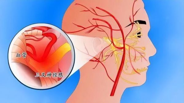 疼痛感的等級怎麼分？疾病類最痛的前五名？止痛藥可以常吃嗎？