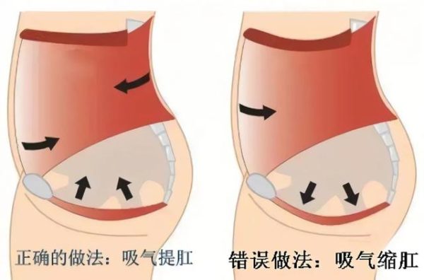 提肛運動對男生、女生有什麼好處？該怎麼做才正確？