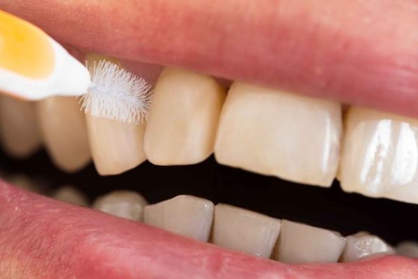 為什麼會牙齦萎縮？要怎麼預防或減少這情況發生？