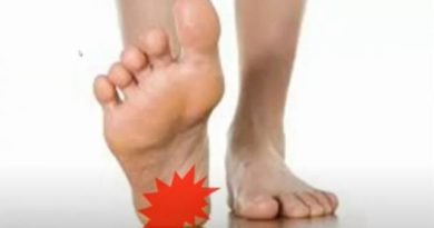 足底筋膜炎的症狀有哪裡？做什麼動作可改善足底筋膜炎的痛楚？