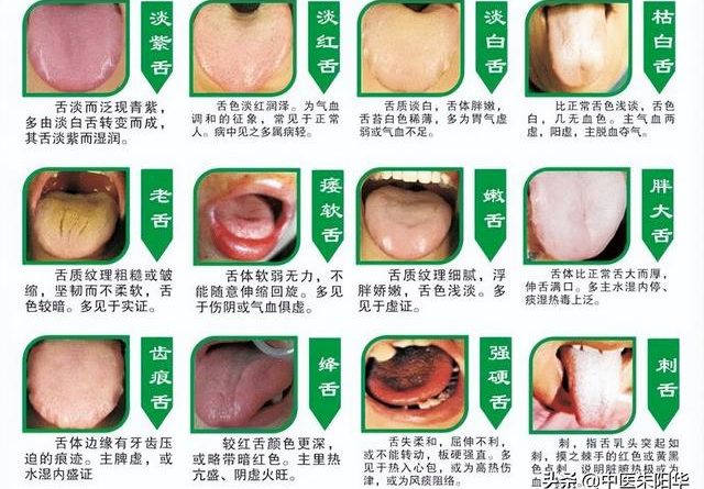 看中醫醫生為什麼要看舌頭？舌頭怎麼看身體狀況？一張圖讓你了解！