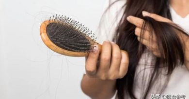 洗頭後發現掉很多頭髮 代表容易或快要禿頭了嗎？